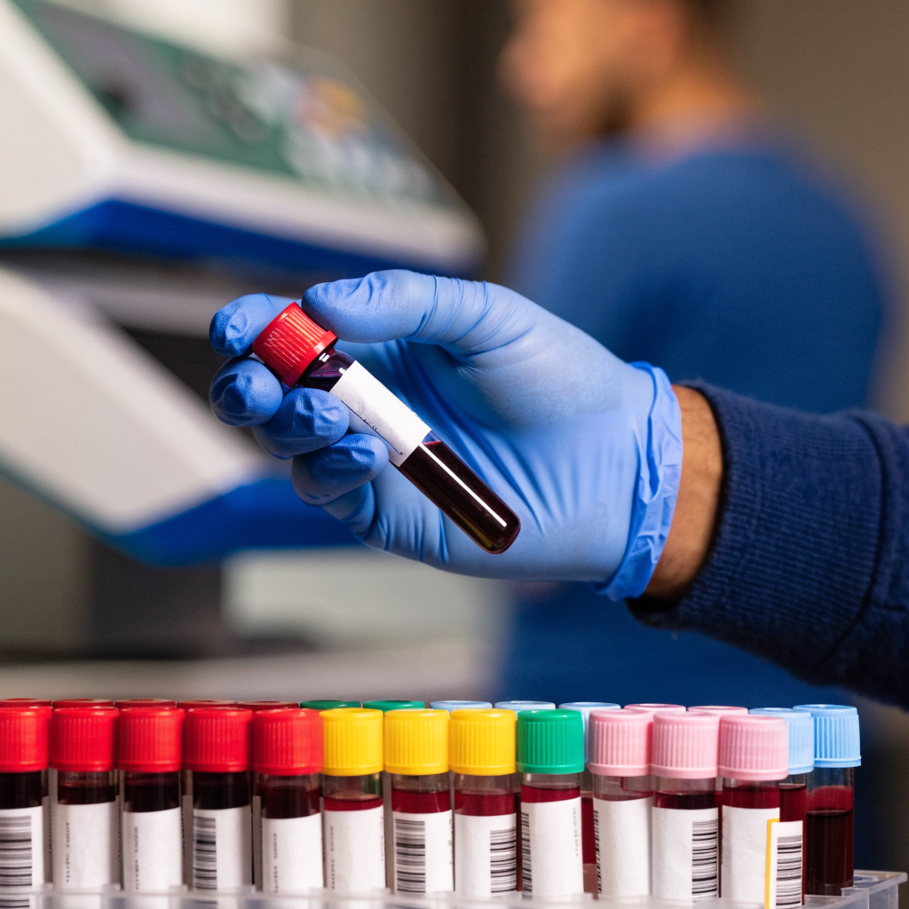A lab technician labeling a blood sample tube for autoantibody testing, illustrating the rise in autoimmune disease markers